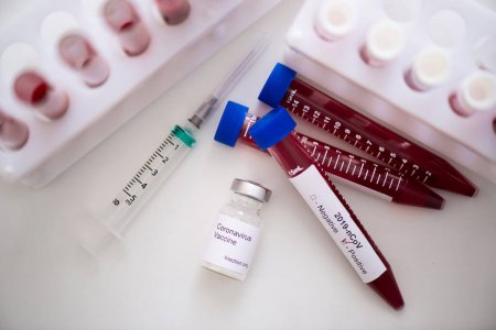 12-майга карата республика боюнча коронавирусту жуктуруунун 21 жаӊы учуру катталды – жалпы 1037