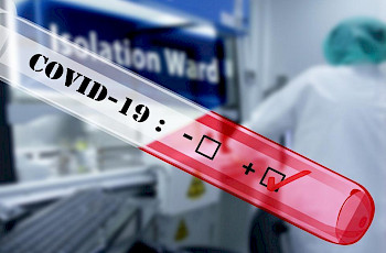 В Кыргызстане скоро будут проводиться анализы на наличие антител к COVID-19